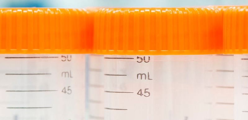 ANTI-SARS-COV-2 RECOMBINANT ANTIBODIES