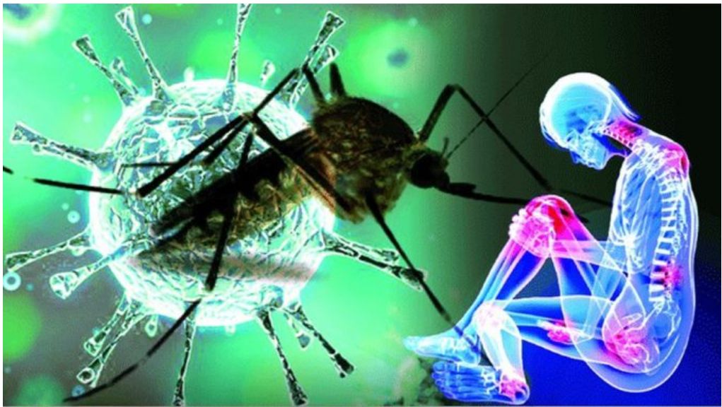 Chikungunya: A Vector Borne Disease