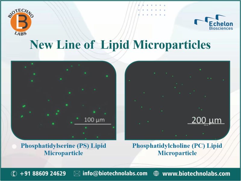 New Line of Lipid Microparticles