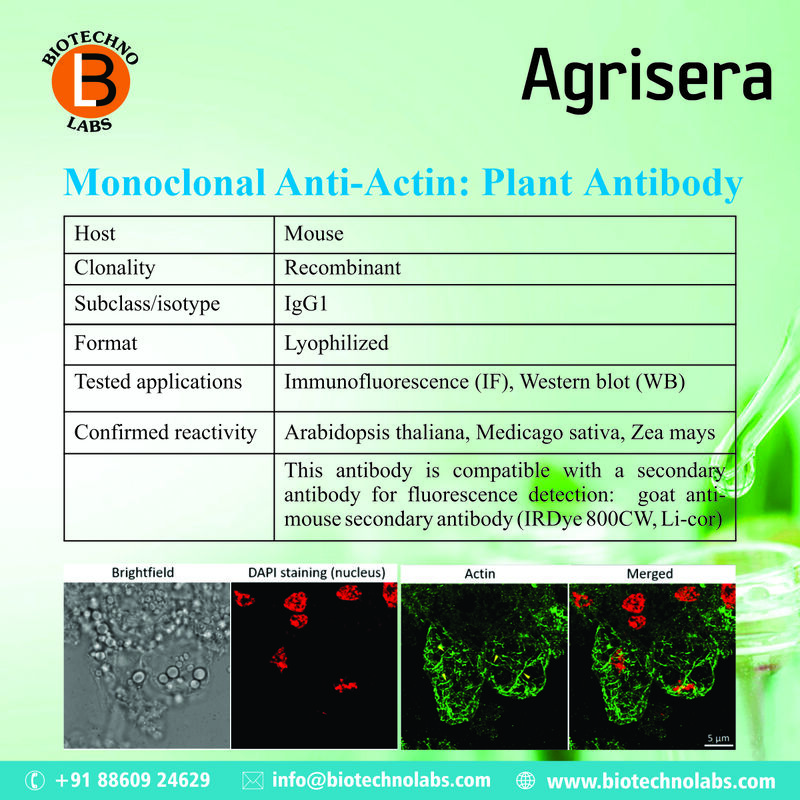 Monoclonal Anti-Actin: Plant Antibody