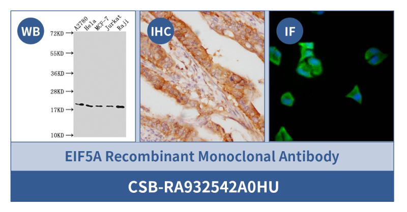 New Product Launch | EIF5A Recombinant Monoclonal Antibody (Cat# CSB-RA932542A0HU)