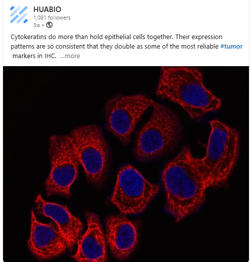 🧬 Cytokeratins: Key Markers in Tumor Identification