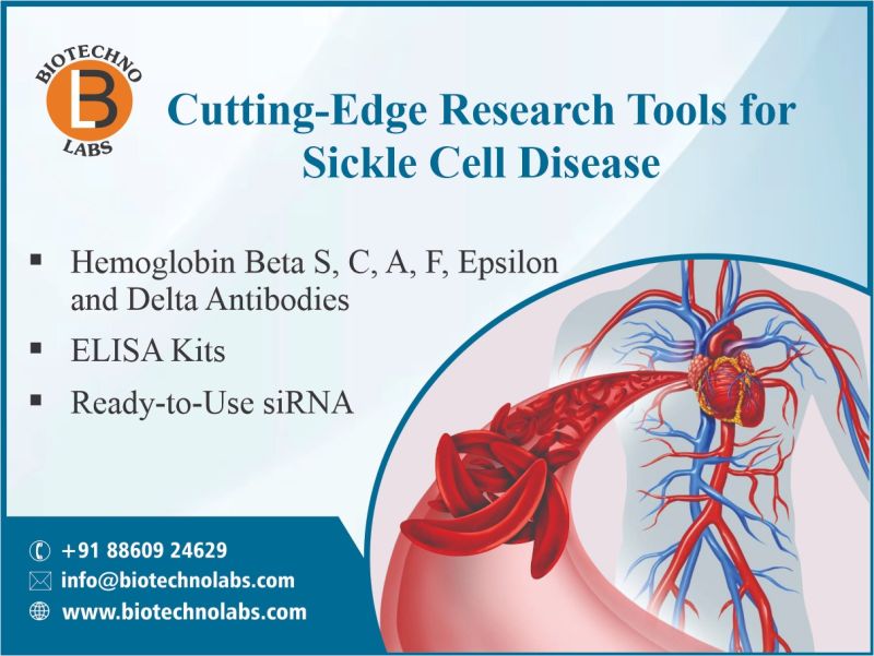 Cutting-Edge Research Tools for Sickle Cell Disease