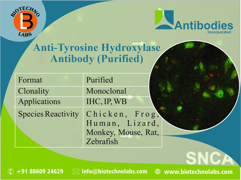 Anti-Tyrosine Hydroxylase Antibody Purified